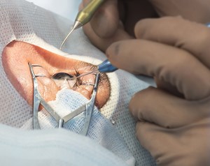 Opthalmic Surgery